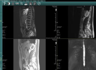 MRT-Aufnahmen mit Wine öffnen MRT
